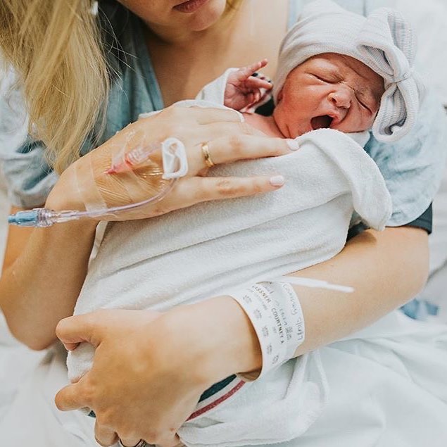 What is a Breech Baby?