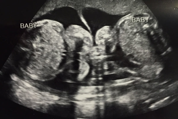 Two to Kiss, Two to Love: Identical or Fraternal